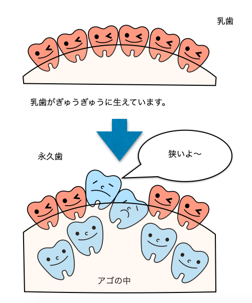永久歯に変わりはじめました。