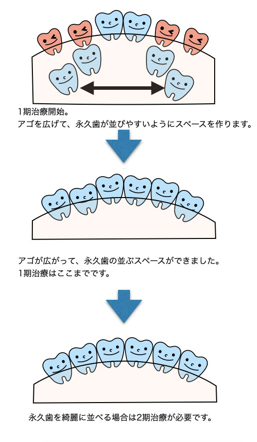 1期治療開始